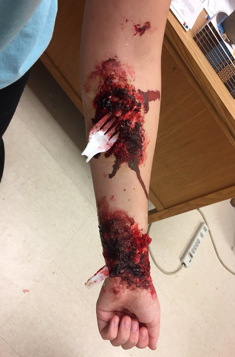 Mary Helen Weatherby, grade 10 was assigned a stab wound to recreate in the lab.
